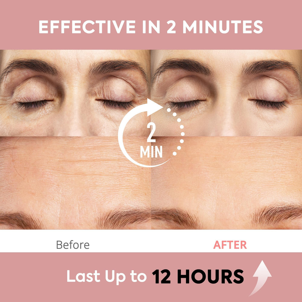 St. Mege Instant Eye and Face Lift Cream under-eye area reducing puffiness for refreshed look