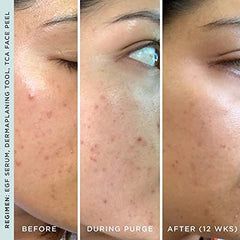 StackedSkincare Hydrating EGF Serum glow finish hints at natural radiance.