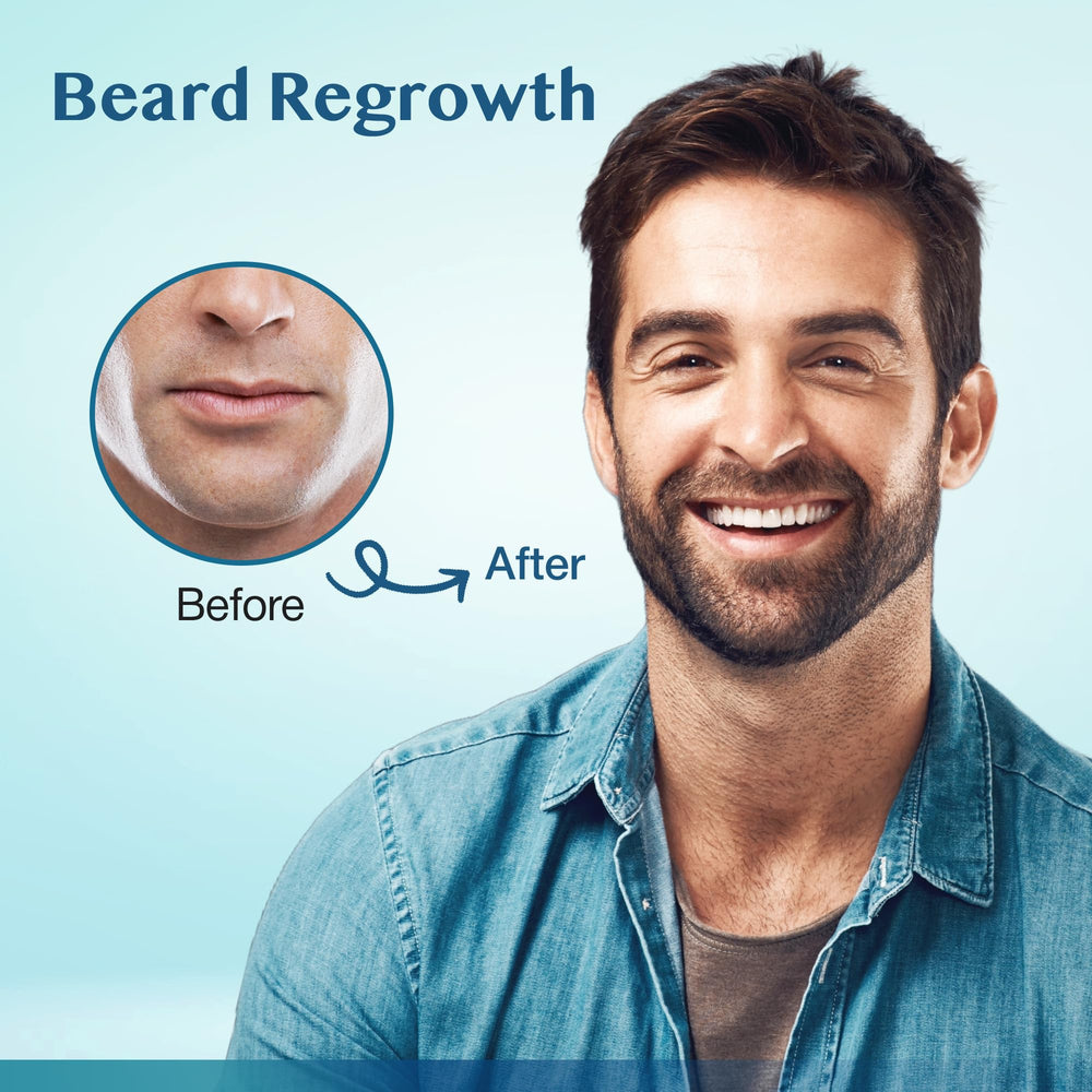 Stafenit thinning scalp area suggests density improvement potential.