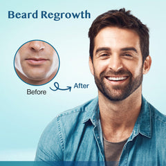 Stafenit thinning scalp area suggests density improvement potential.