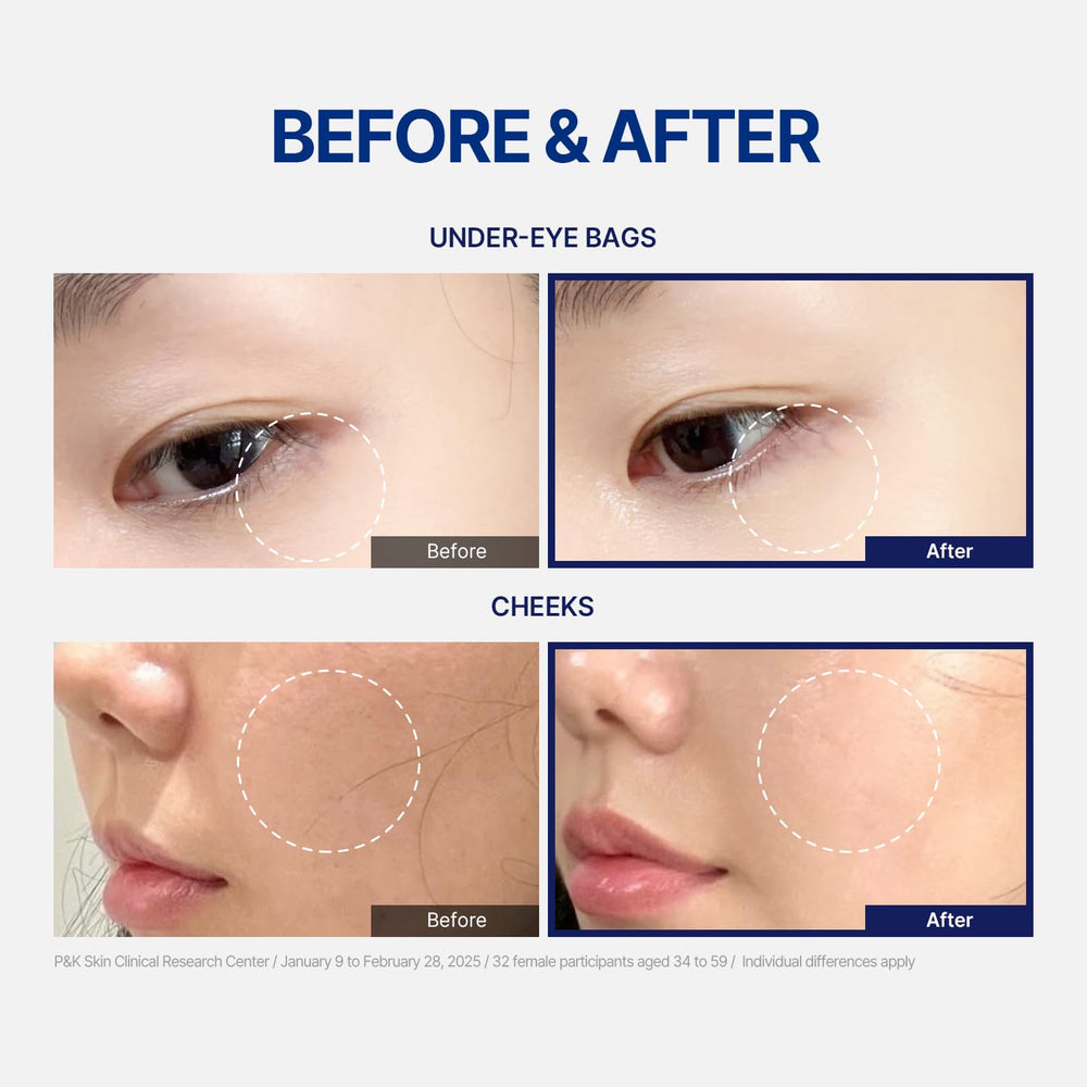 StayUth Wrinkle Spot Serum with hyaluronic-acid for lasting hydration