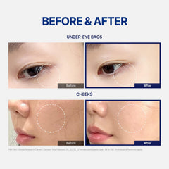 StayUth Wrinkle Spot Serum with hyaluronic-acid for lasting hydration