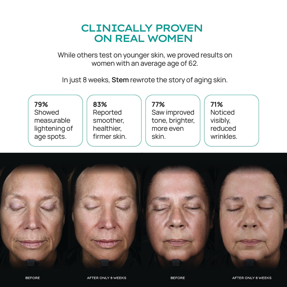 STEM Natural Intelligence Revitalize Night Cream ingredients panel notes niacinamide and stem cells