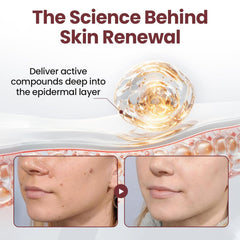 STIEKIET professional skin-treatment pack shown for salon-like results