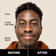 Stryx Concealer Stick Twist-Click demonstrates precise control for natural-looking concealment.