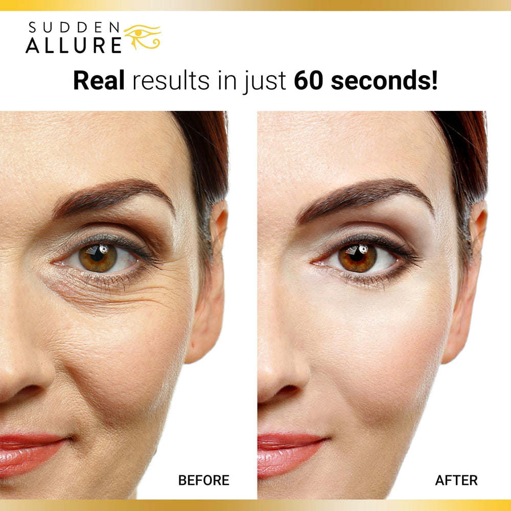 SuddenAllure eye area after 60 seconds appears smoother and firmer.