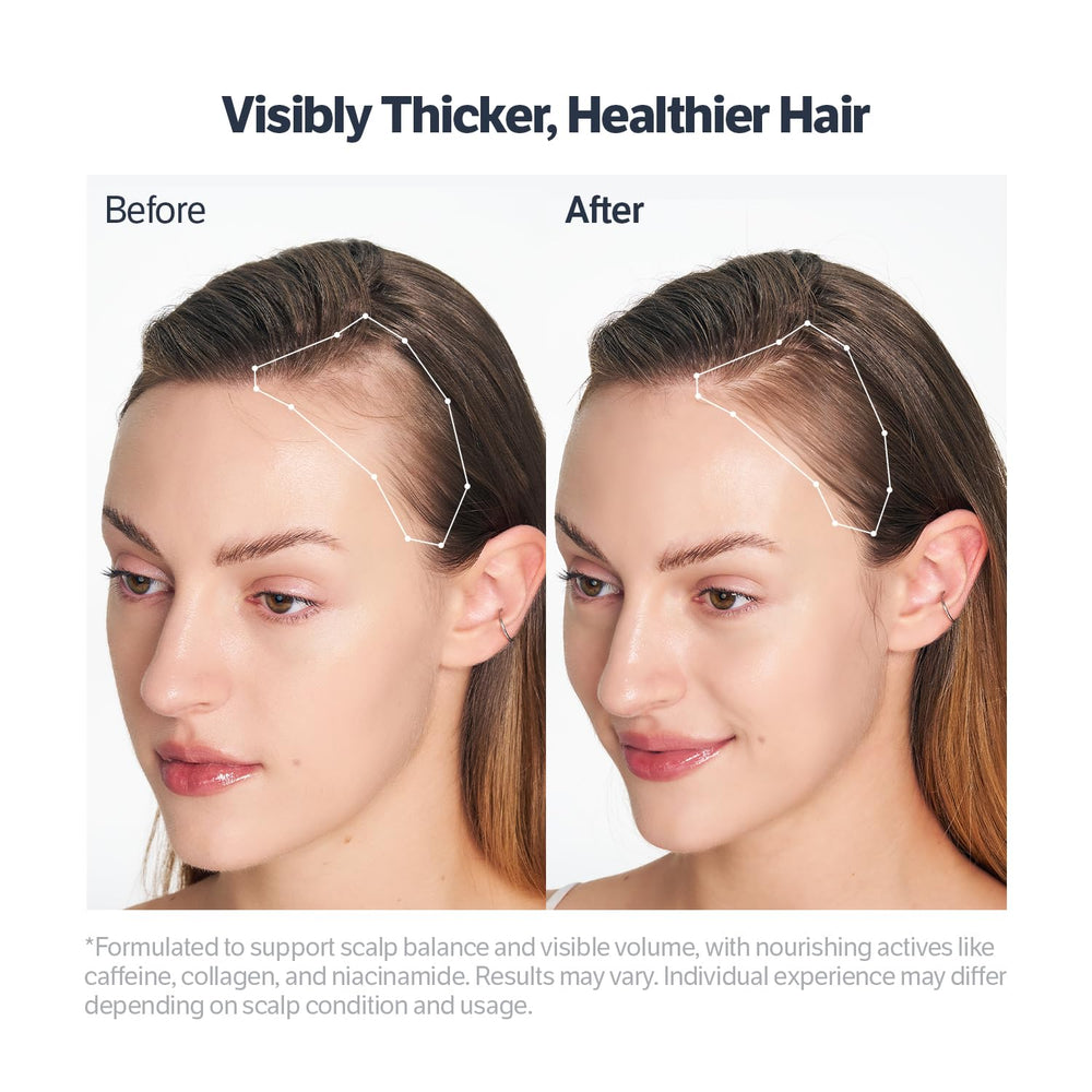 Close-up of dry scalp before treatment with SUNGBOON EDITOR serum
