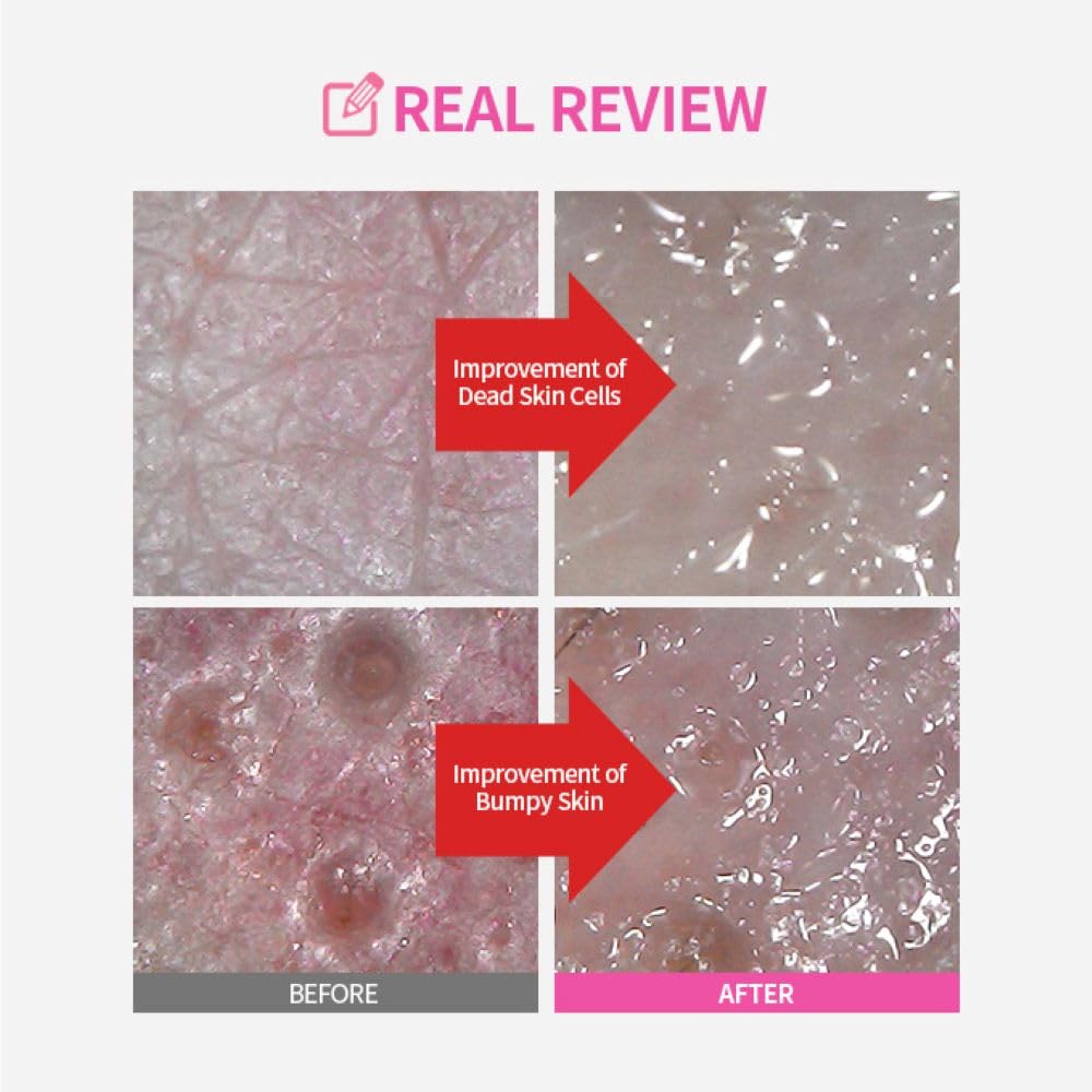 SUNGBOON EDITOR Exfoliation pad application close-up demonstrates texture refinement.