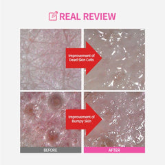 SUNGBOON EDITOR Exfoliation pad application close-up demonstrates texture refinement.