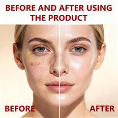 Sunohyesla Hyaluronate-rich nourishment applied to skin for hydration