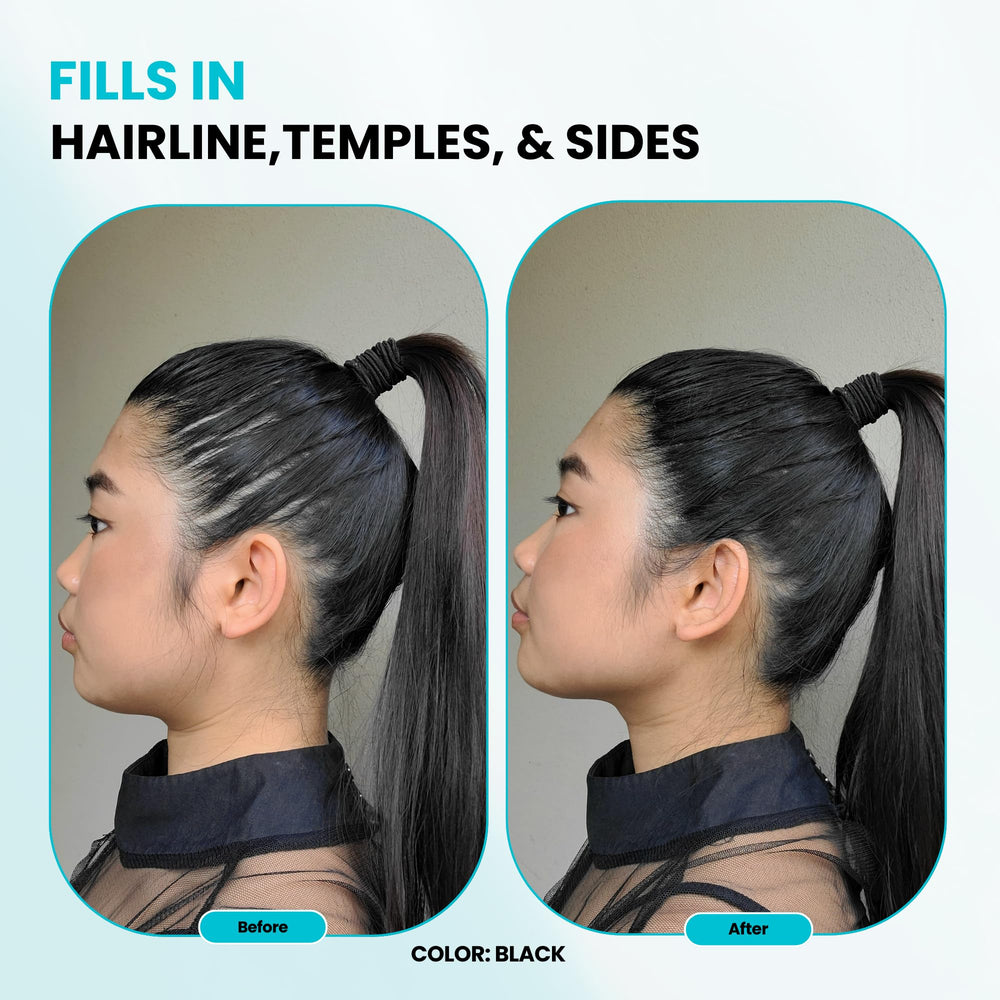 SURETHIK Hair Fibers before-after look showing fuller appearance.