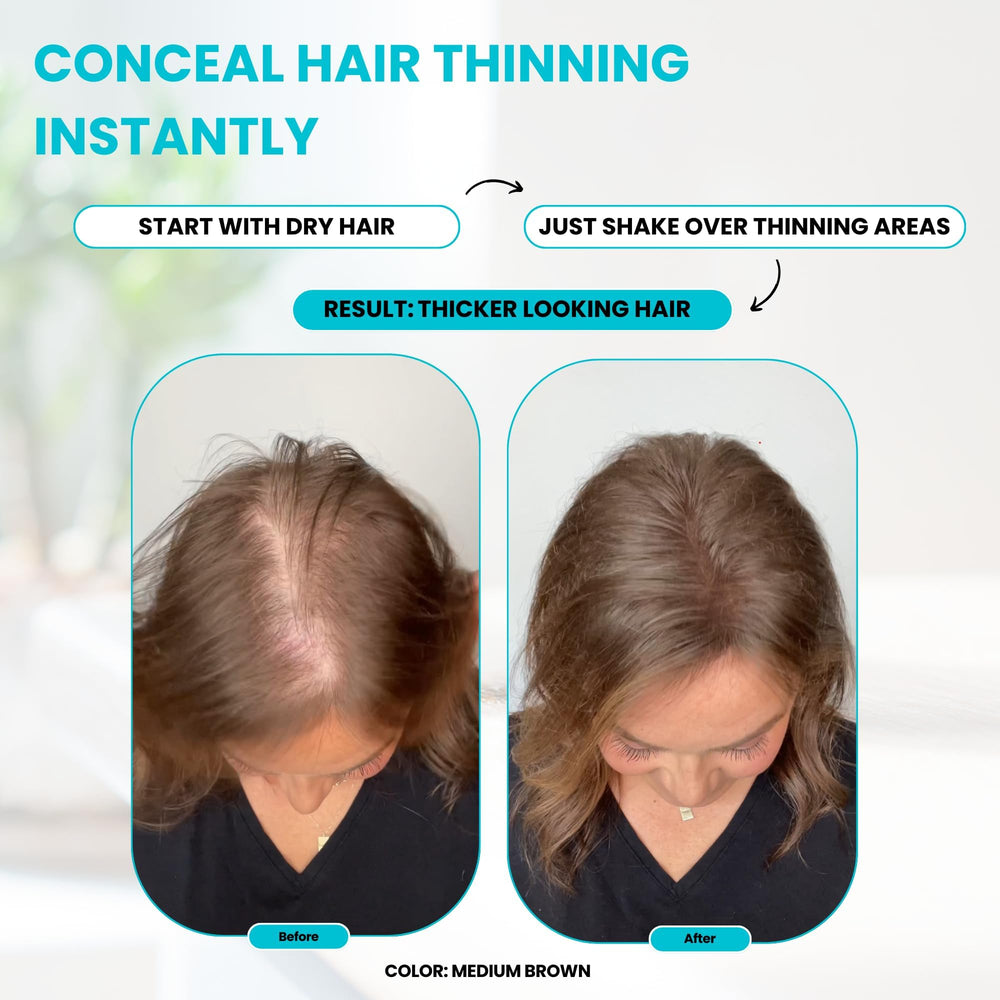 Surethik Light Blonde fibers on hair provide natural concealment and bounce