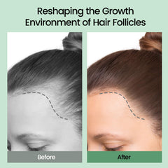 Sysni Rosemary Tea Tree Keratin Shampoo targets hair roots for nourishment.