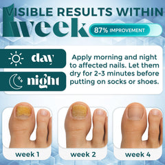 Tammy Taylor Thymolize toe nail close-up showing clear formula