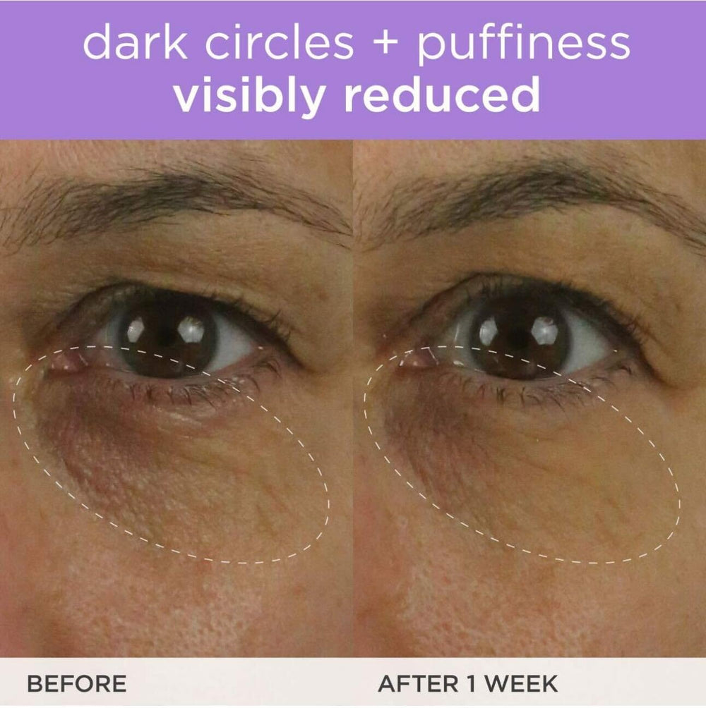 Skin-aligned application of the eye cream on the under-eye area