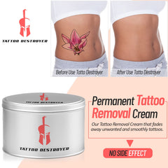 Tattoo Destroyer box shown for private home use.