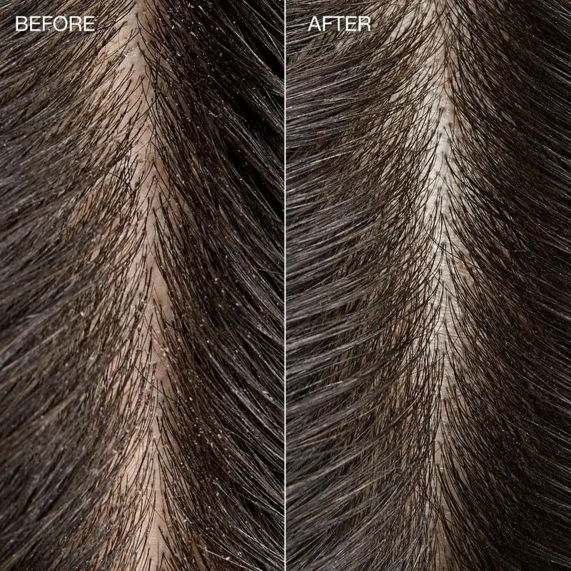 Scalp close-up after use showing clean, refreshed look.