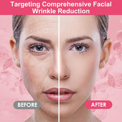 TEAWOO smile lines patches for hydration and subtle plump