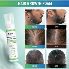 Odorless TeCFLOX Minoxidil Foam formula for discreet application