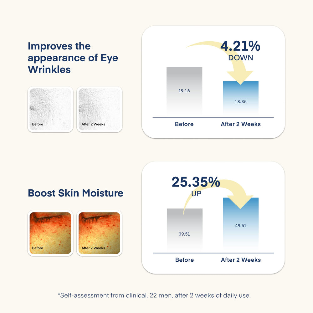 TEREZ & HONOR eye-area visual hints at reduced under-eye puffiness