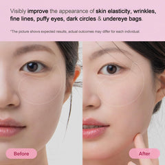 Terez and Honor patches apply to delicate under-eye area to reduce puffiness.