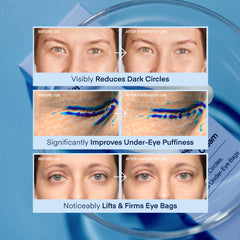 TEREZ & HONOR hyaluronic acid for lasting under-eye hydration
