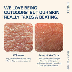 TERNS Sirenas Complex AQ science box highlights advanced antioxidant protection.