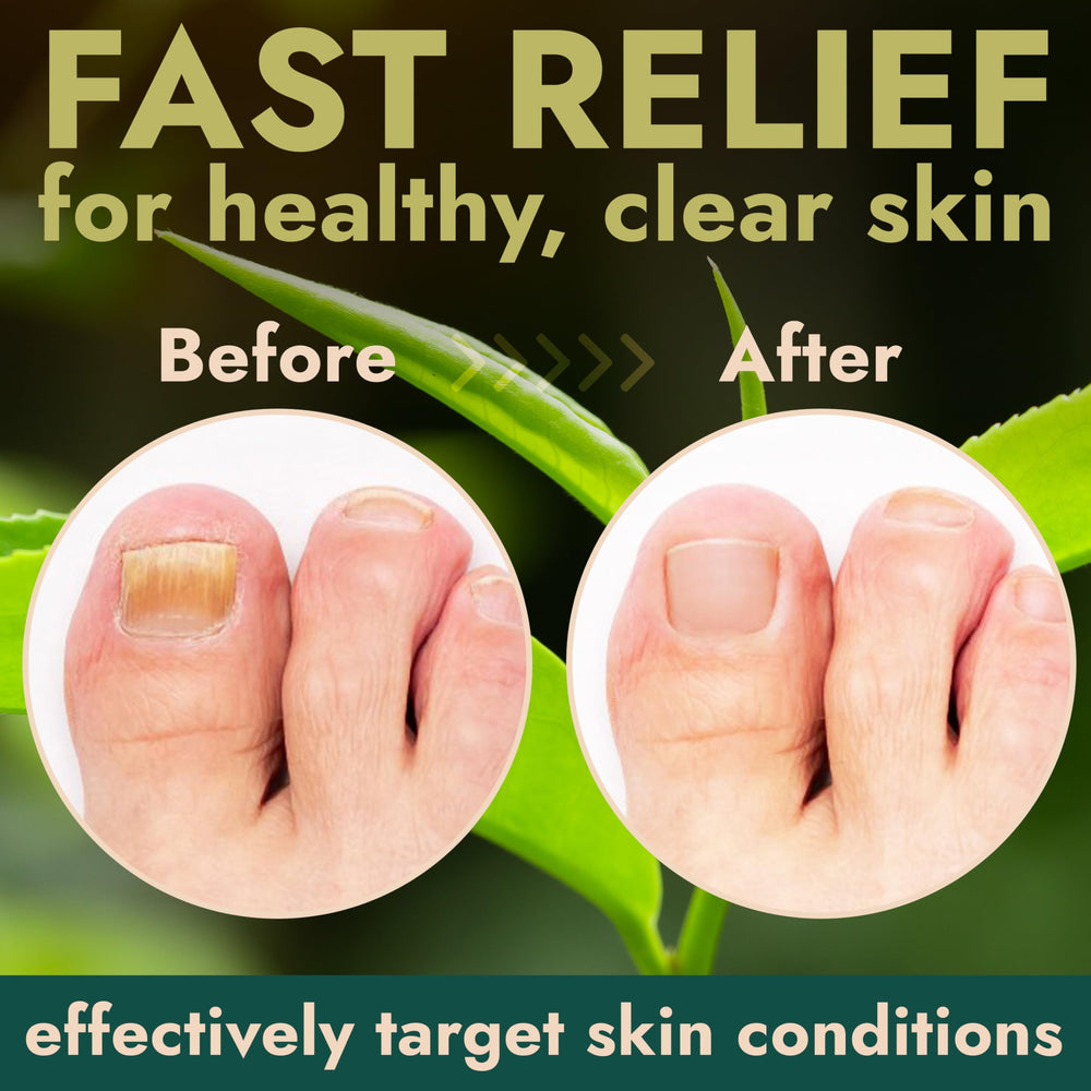 Terramed Just Think Comfort foot care bottle ready for daily home use