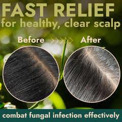 Natural botanical ingredients including tea tree support a clean, balanced scalp.