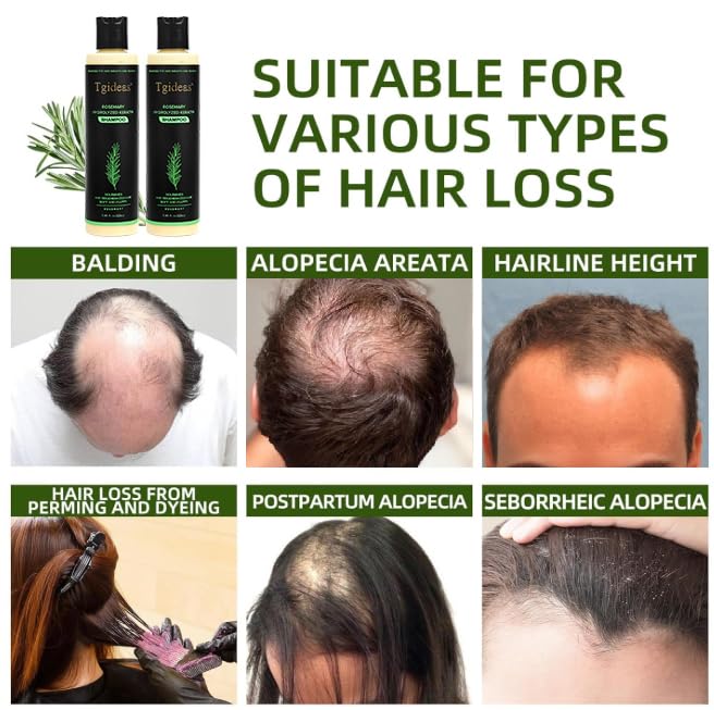 Tgideas rosemary shampoo application on wet hair for cleansing