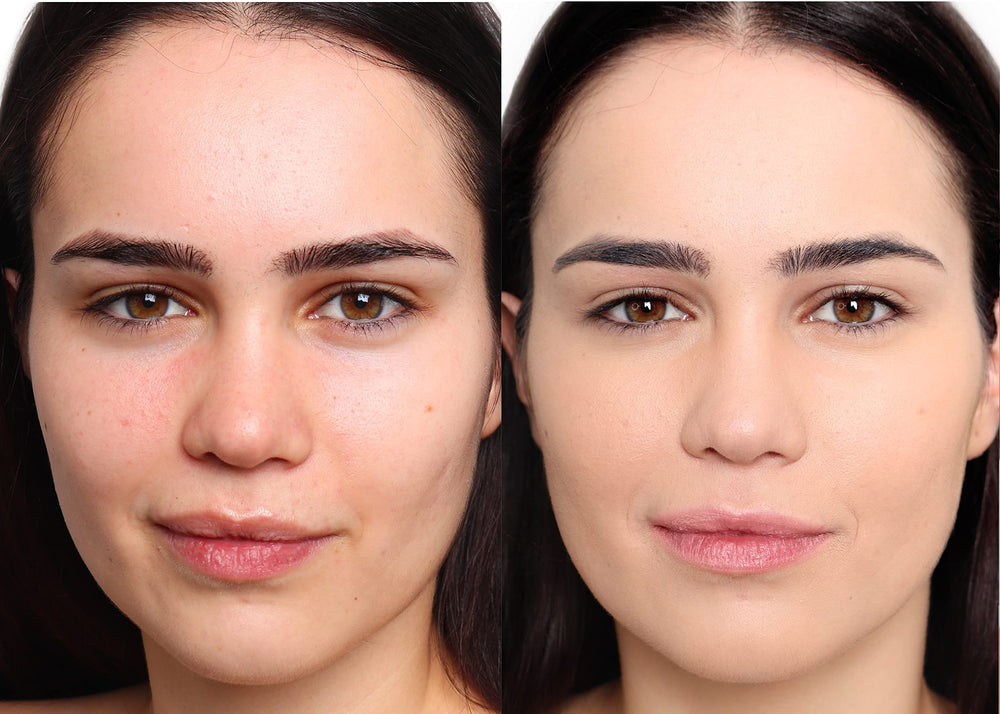 The Good Mineral Loves-You-Back supports sensitive, acne-prone skin with oil-free coverage