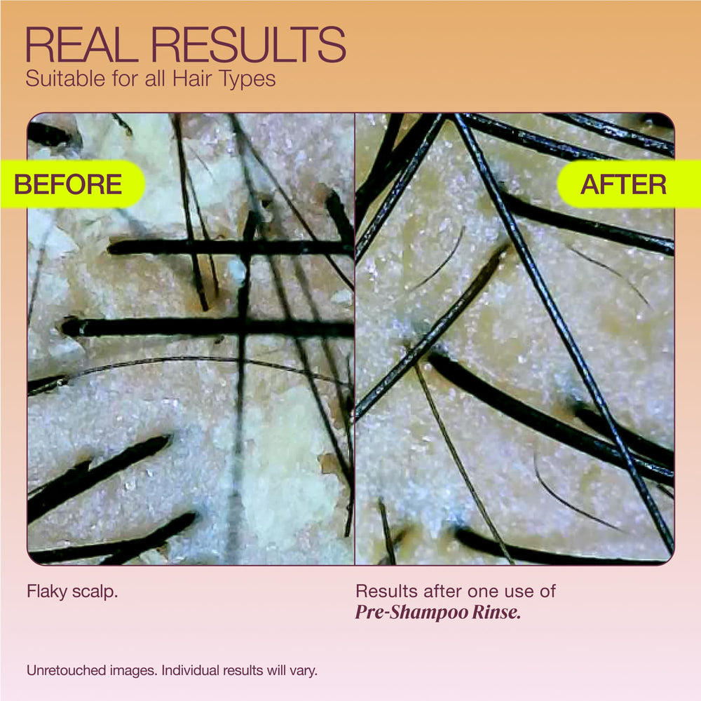 THE ROOTIST Pre-Shampoo massaging on scalp demonstrating gentle exfoliation