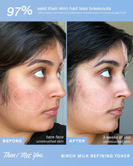 Then I Met You Birch Milk Toner travel size for on-the-go skincare.