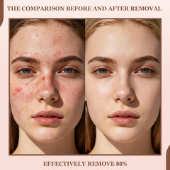 THESHYING duo on vanity, ready for daily exfoliation and hydration.