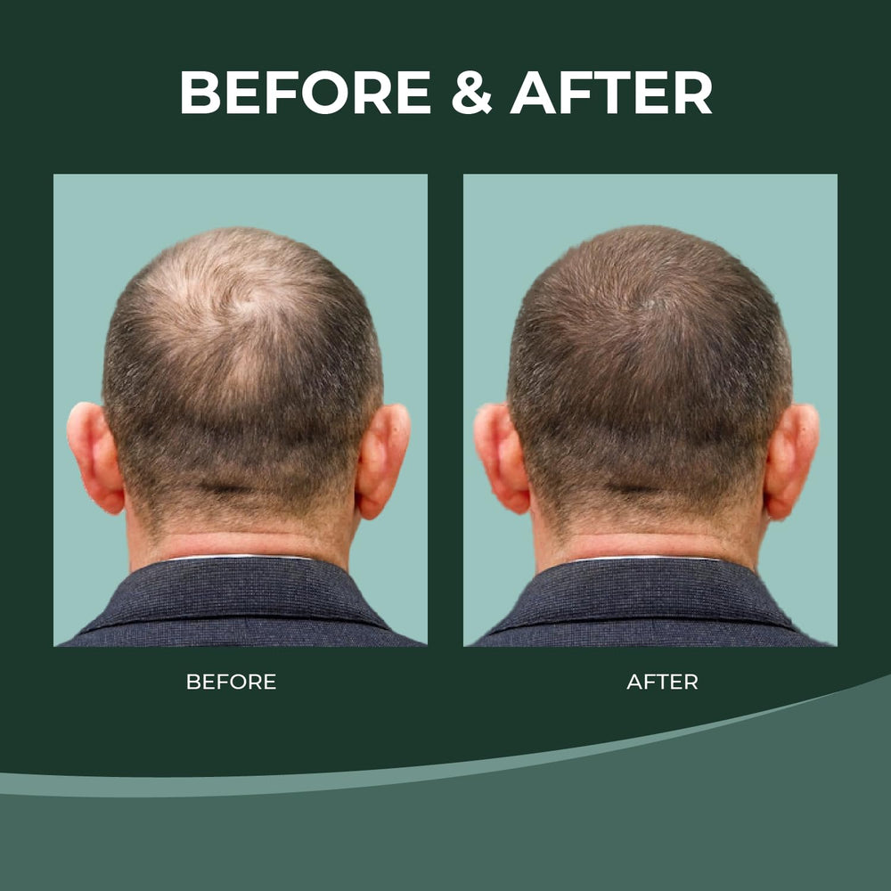 Thik&Fix hair thickening effect visual suggesting fuller look
