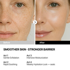 THOME G‑Peel four‑step sheet, professional exfoliation in a travel-friendly format
