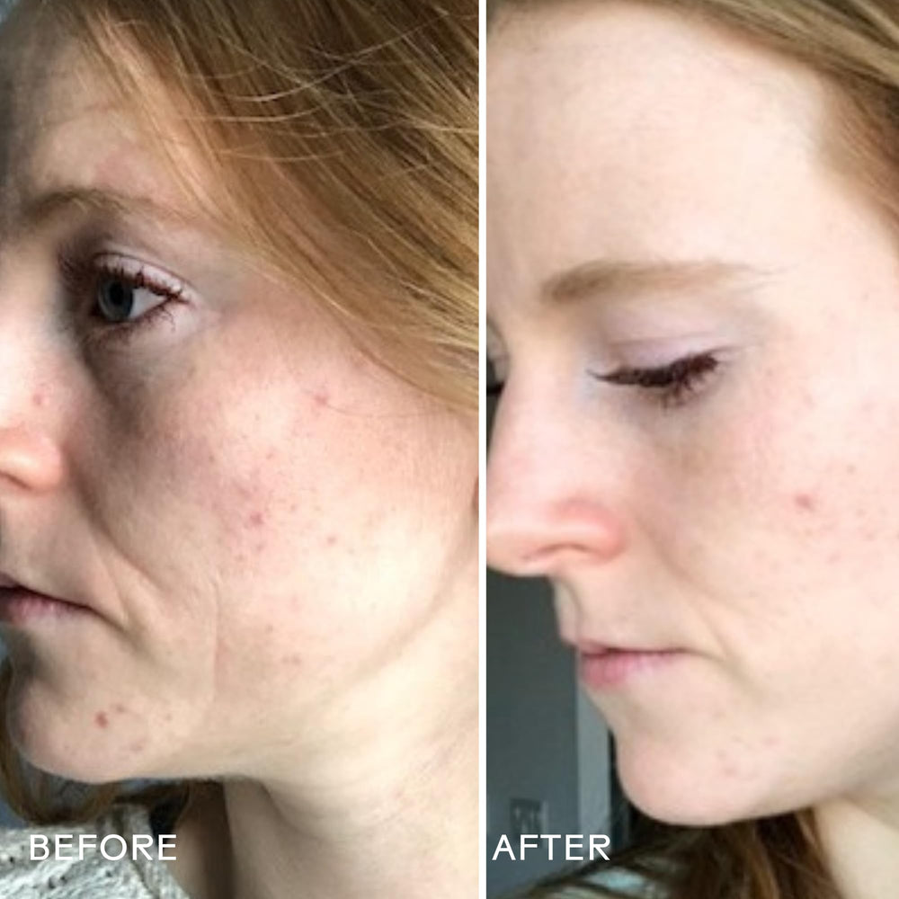 Close-up of cleanser foam demonstrating gentle cleansing action
