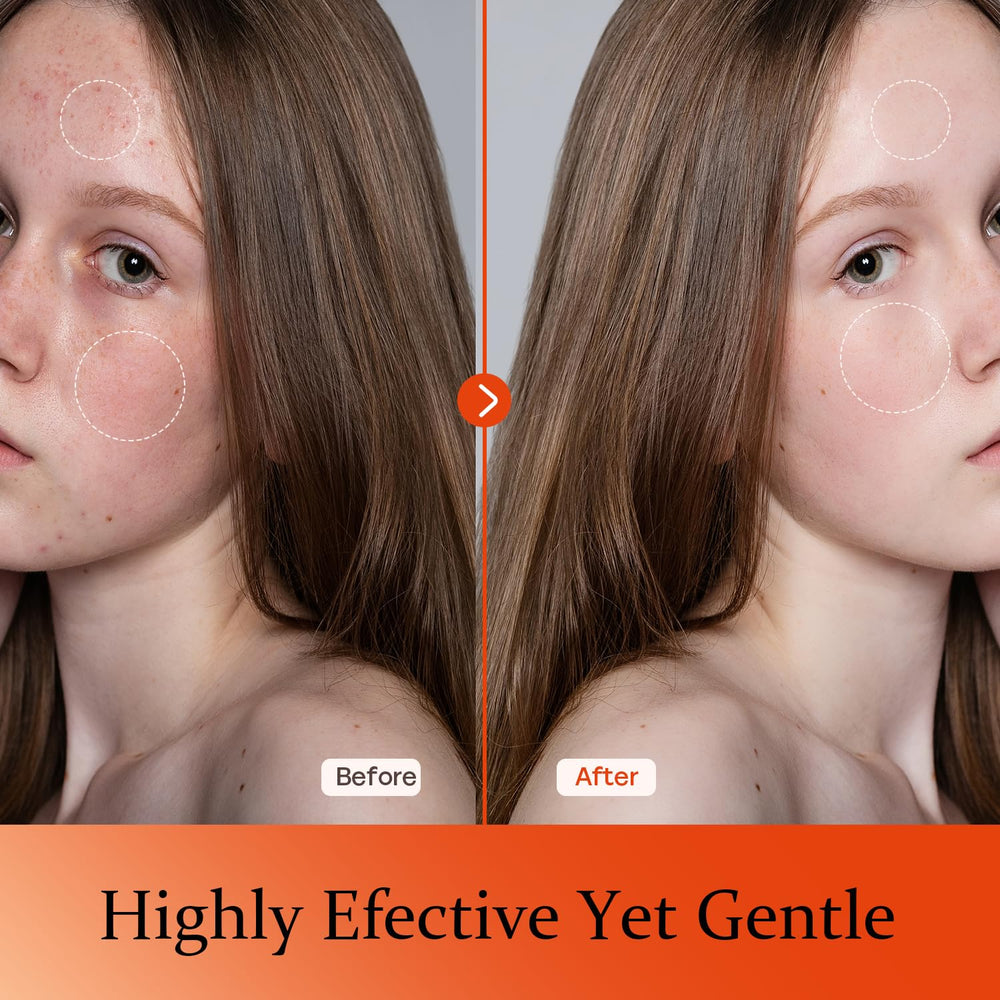 Tinclen Vitamin C Serum on skin with bright glow and even tone