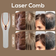 TMOSSO Laser Therapy Hair Growth Comb portable design for travel-friendly care.