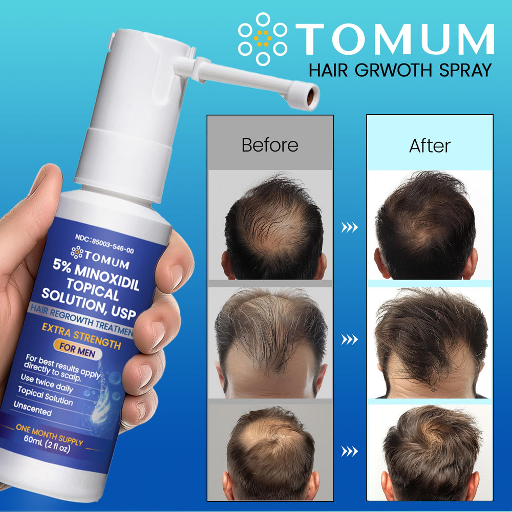 Tomum Minoxidil spray 60ml bottle for easy daily use.