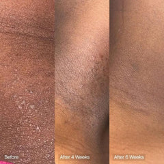 Topicals Faded cleansing bar ingredients graphic highlights kojic acid and vitamin C.
