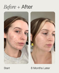 Topicals Faded spot-reduction illustration suggests fading discoloration over time