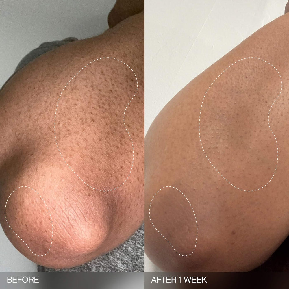 Topicals Slather Exfoliating Bar delivers hydration during exfoliation
