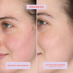 Tower 28 SOS Rescue Serum fragrance-free label highlights skin-friendly care.