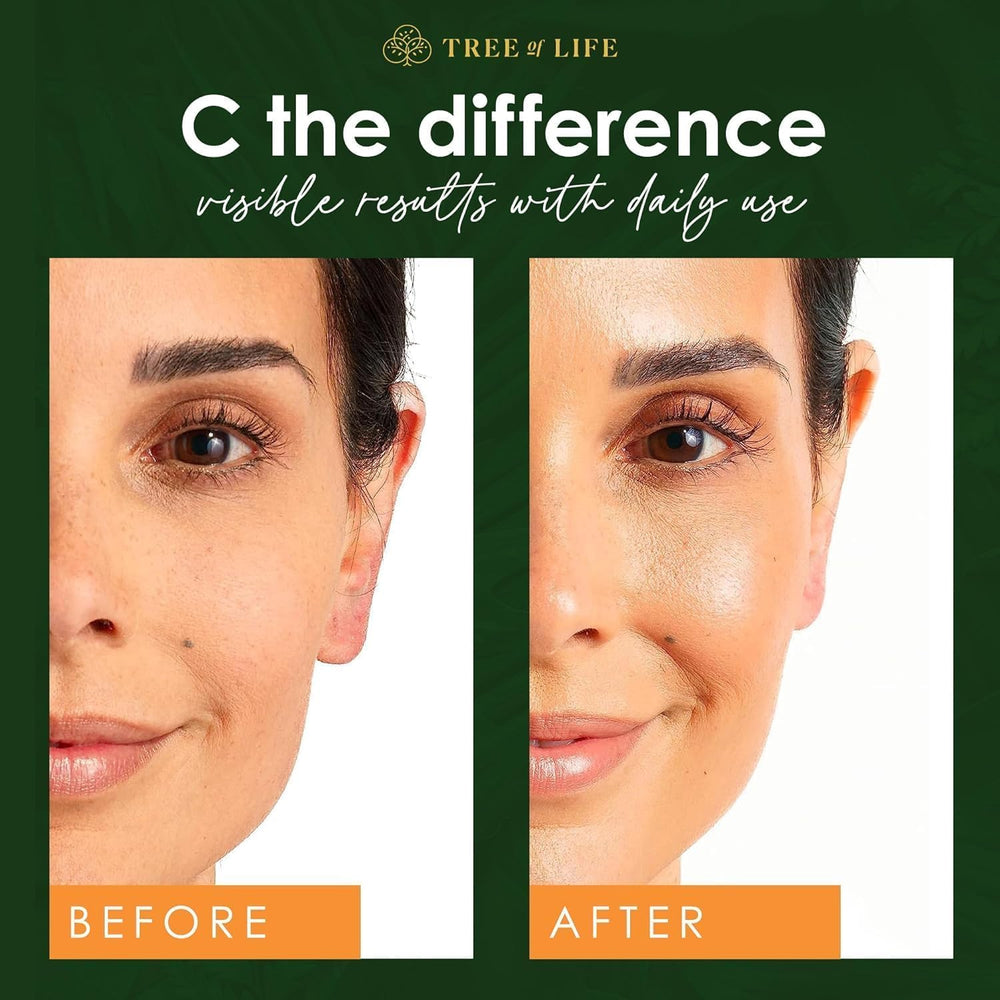 Tree of Life Beauty vitamin C vitamin E ingredient glow enhancement for sensitive skin