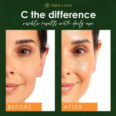 Tree of Life Beauty vitamin C vitamin E ingredient glow enhancement for sensitive skin