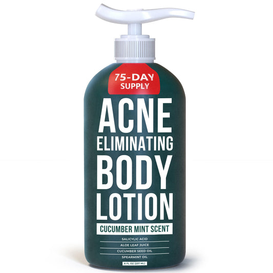 TreeActiv Acne Eliminating Body Lotion bottle with cucumber mint scent for refreshing skin.