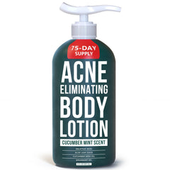 TreeActiv Acne Eliminating Body Lotion bottle with cucumber mint scent for refreshing skin.