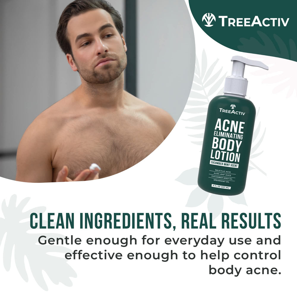 TreeActiv Acne Eliminating Body Lotion packaging display highlighting all-day moisture.