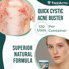 TreeActiv aloe soothing detail on skin demonstrates gentle support for sensitive skin.